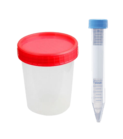 Kit per la raccolta del liquido seminale per il Tunel Test / FISH nel test di Eurofins Genoma, composto da un contenitore a bocca larga e una provetta da 15ml.